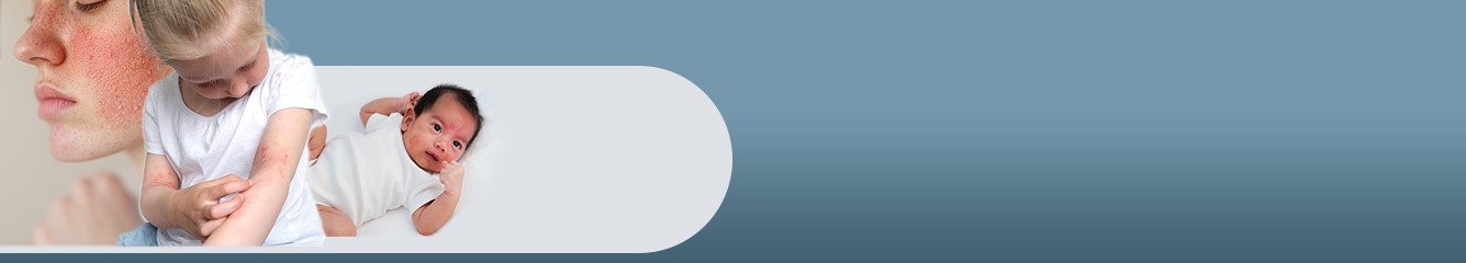 Collaborating on Individualized Management Solutions for Pediatric Patients with Moderate-to-Severe Atopic Dermatitis