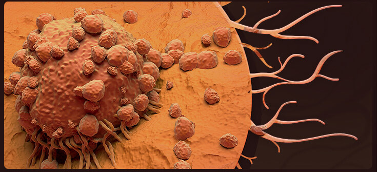Pathways to Developing Personalized Treatment Regimens for Patients with Advanced Melanoma
