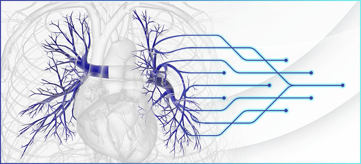 Using Implementation Science to Improve Multidisciplinary Diagnostic and Treatment Pathways for Patients With PAH