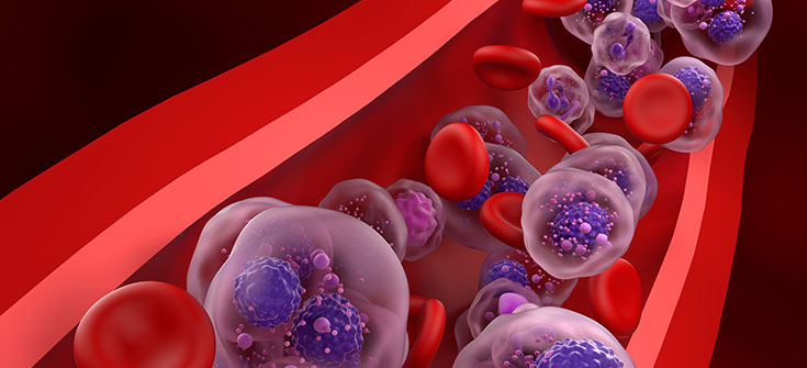 Sustainable and Scalable Strategies for Safe and Effective Administration of Bispecific Antibodies for Relapsed/Refractory Multiple Myeloma in Outpatient and Community Settings