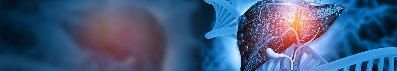 Are You and Your Team Ready? Evolving Opportunities to Identify At-Risk Patients and Change the Trajectory of Alpha-1 Antitrypsin Deficiency (AATD)-Associated Liver Disease