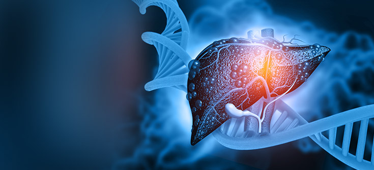 Are You and Your Team Ready? Evolving Opportunities to Identify At-Risk Patients and Change the Trajectory of Alpha-1 Antitrypsin Deficiency (AATD)-Associated Liver Disease